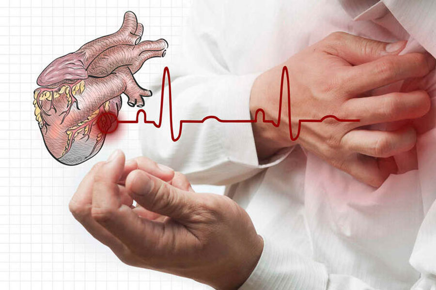Otto maschi valdostani su cento sono ad alto rischio infarto e ictus Otto maschi valdostani su cento sono ad alto rischio infarto e ictus