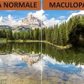Lotta alle maculopatie, venerdì 14 maggio ad Aosta esami gratuiti