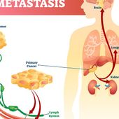 Ad Aosta la prima 'Panchina per la vita' contro il tumore metastatico