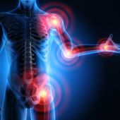 Webinar on air; dolore e stanchezza in reumatologia
