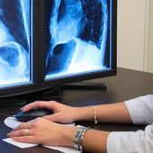 Usl, tornati disponibili i cd per immagini e referti radiologici