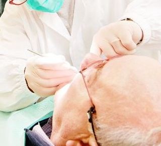 Odontoiatria sociale, in sei mesi 115 prestazioni gratuite e 61 persone prese in carico in Valle