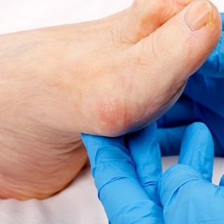 Ogni passo conta: un incontro per proteggere i piedi dal diabete