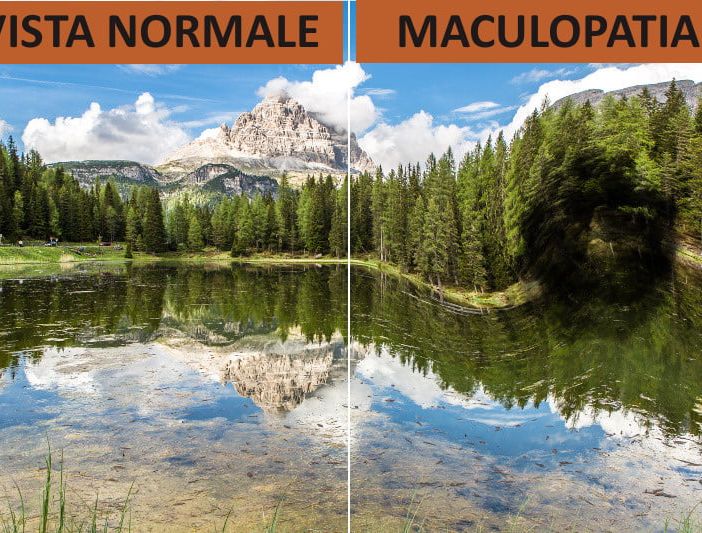 Lotta alle maculopatie, venerdì 14 maggio ad Aosta esami gratuiti