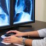 Usl, tornati disponibili i cd per immagini e referti radiologici