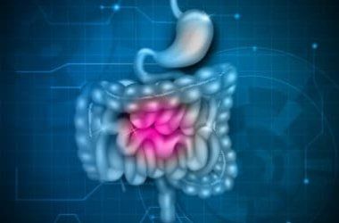 La sindrome dell'intestino irritabile; fitoterapia funzionale a cura del Dr. Stefano Manera