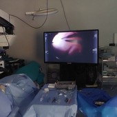 Nuovo ambulatorio chirurgico di oculistica all'ospedale Beauregard