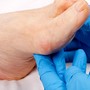 Ogni passo conta: un incontro per proteggere i piedi dal diabete