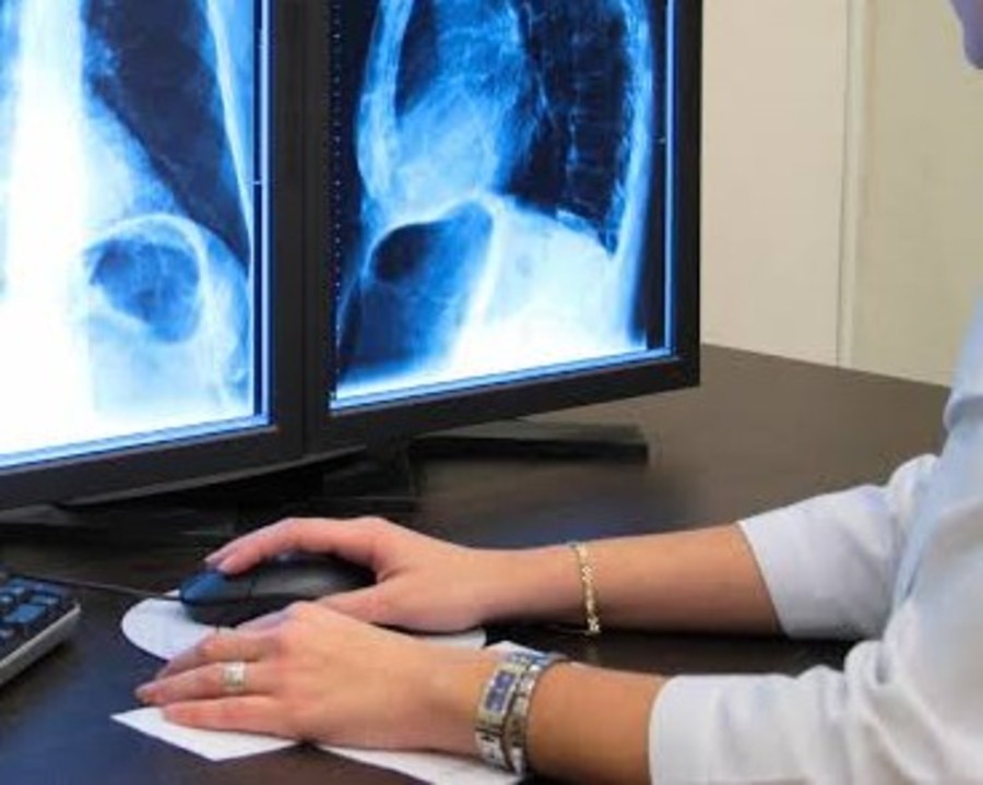 Usl, tornati disponibili i cd per immagini e referti radiologici Usl, tornati disponibili i cd per immagini e referti radiologici