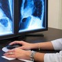 Usl, tornati disponibili i cd per immagini e referti radiologici Usl, tornati disponibili i cd per immagini e referti radiologici