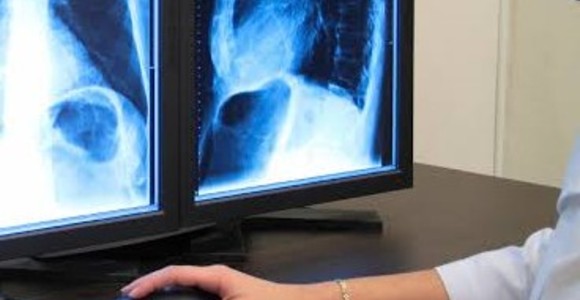 Usl, tornati disponibili i cd per immagini e referti radiologici